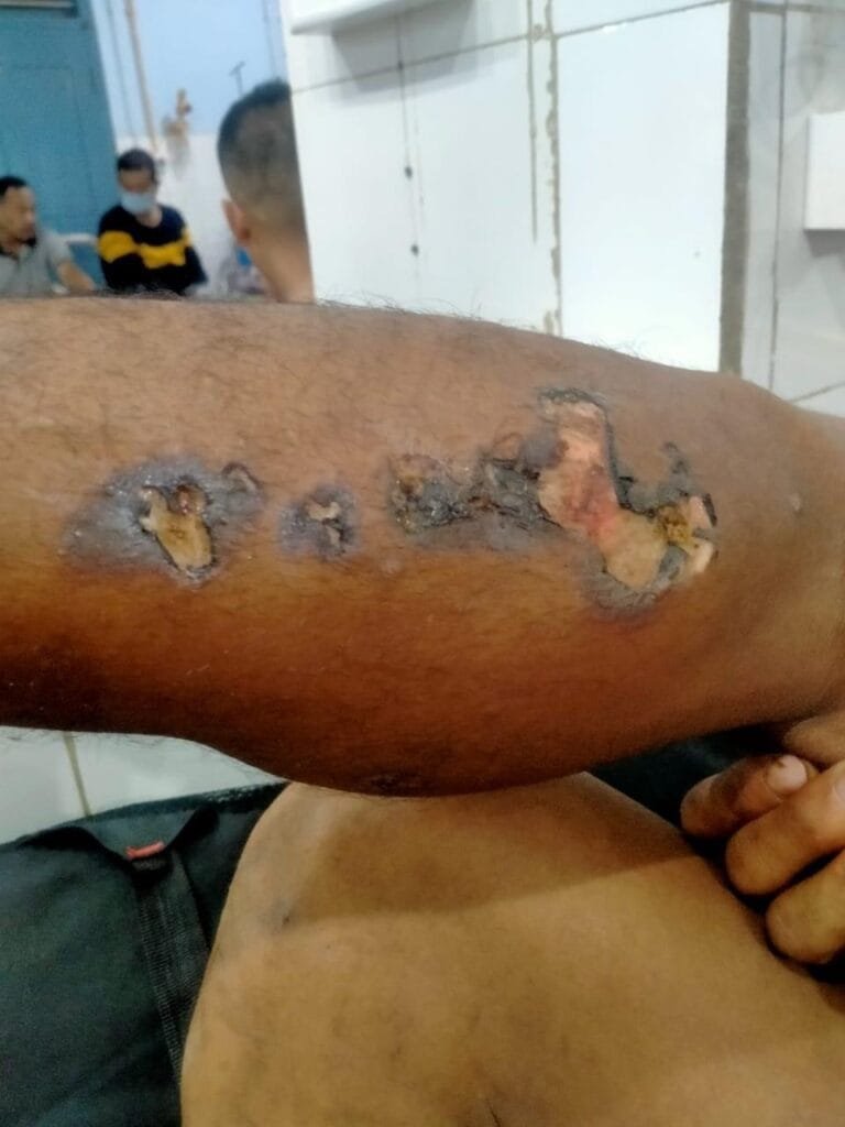 One electrocuted in Mailiang village, another critically injured 2 E74A2BE0 F1B2 4A03 A1AB 46510BA2C599